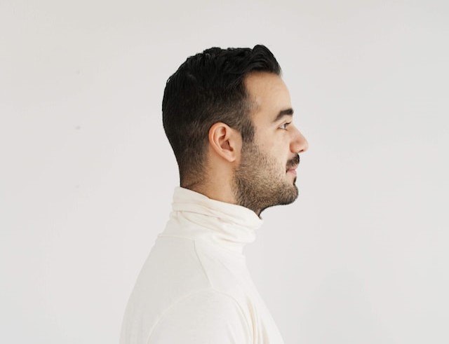 haartransplantatie